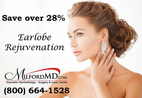 Earlobe Rejuvenation By MilfordMD