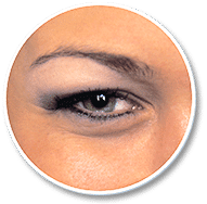 Eyelid Rejuvenation