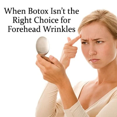 When Botox Isnt Right Choice Forehead Wrinkles By MilfordMD