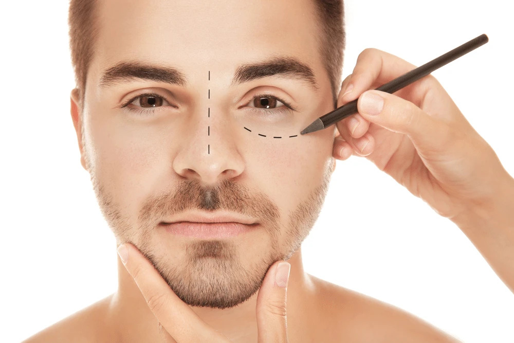 How Long Does It Take to Recover From Blepharoplasty by MilfordMD