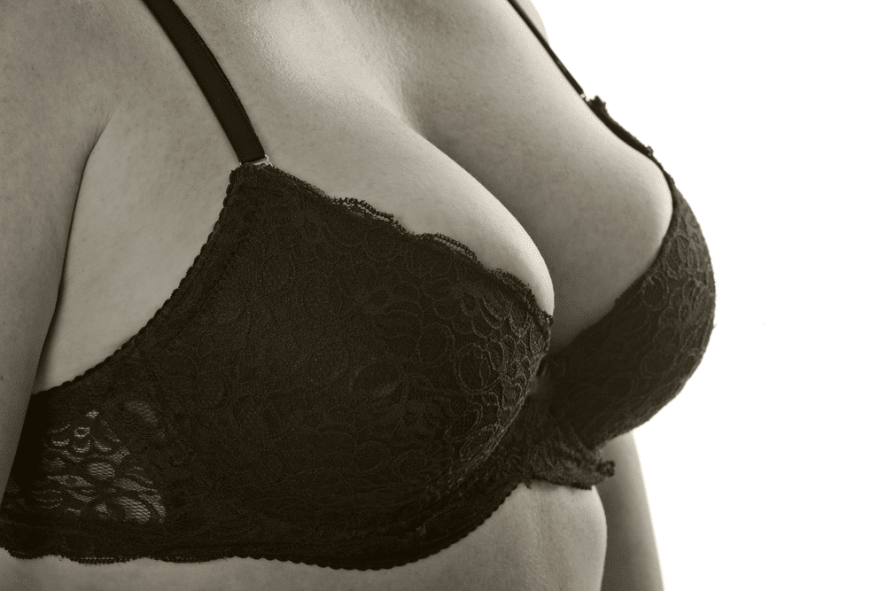 How Long Does a Breast Lift Last? | Milford MD