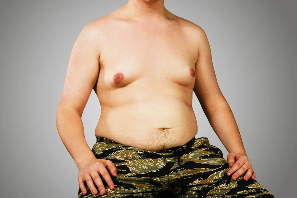 How Can You Get Rid of Gynecomastia