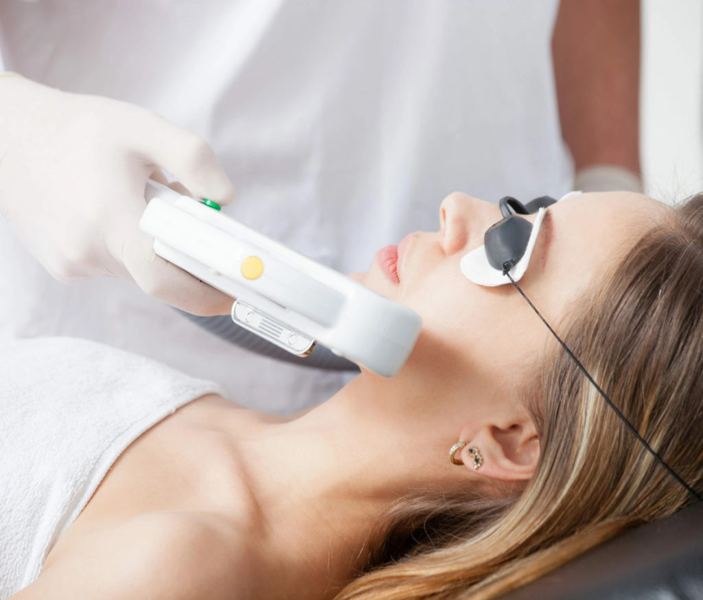 Laser Face Rejuvenation for Better Skin 9 Things You Must Know by MilfordMD