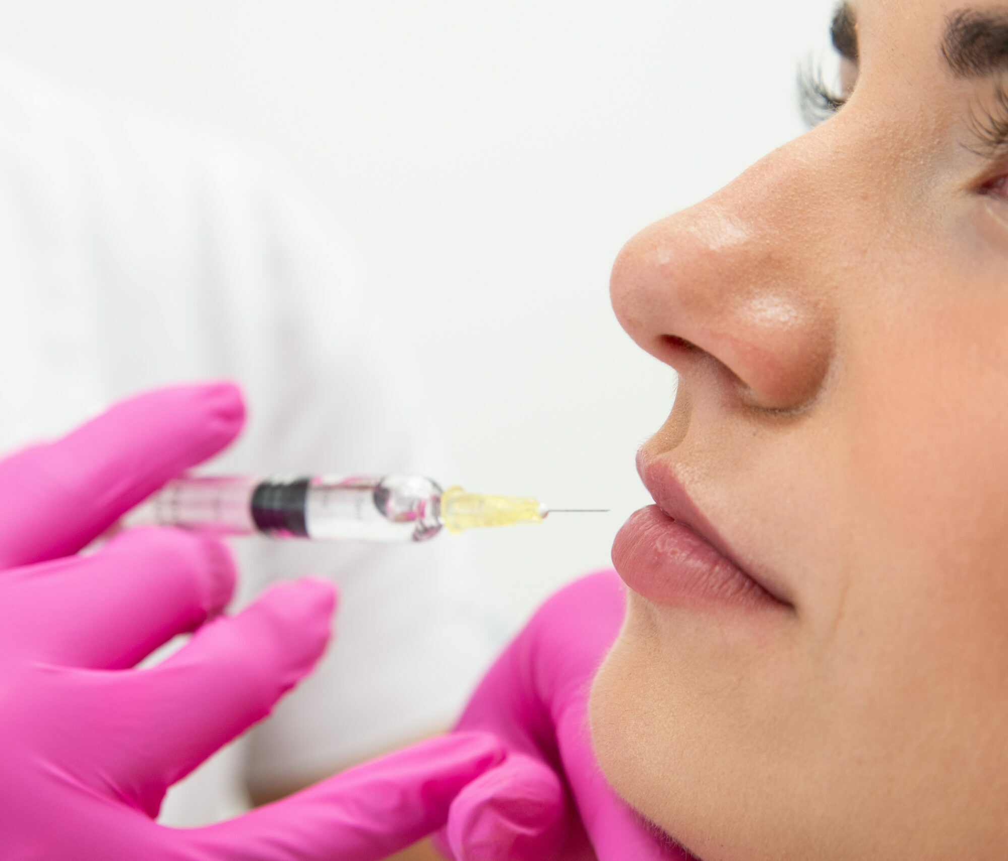 How Does Juvederm Voluma Work | Milford MD Cosmetic Dermatology