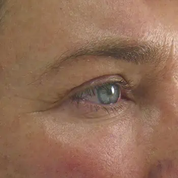 before-treatment-img