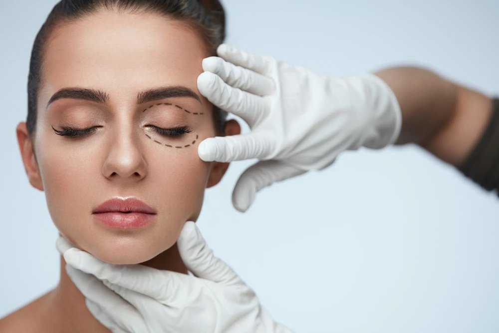 Who Is a Good Candidate for Blepharoplasty