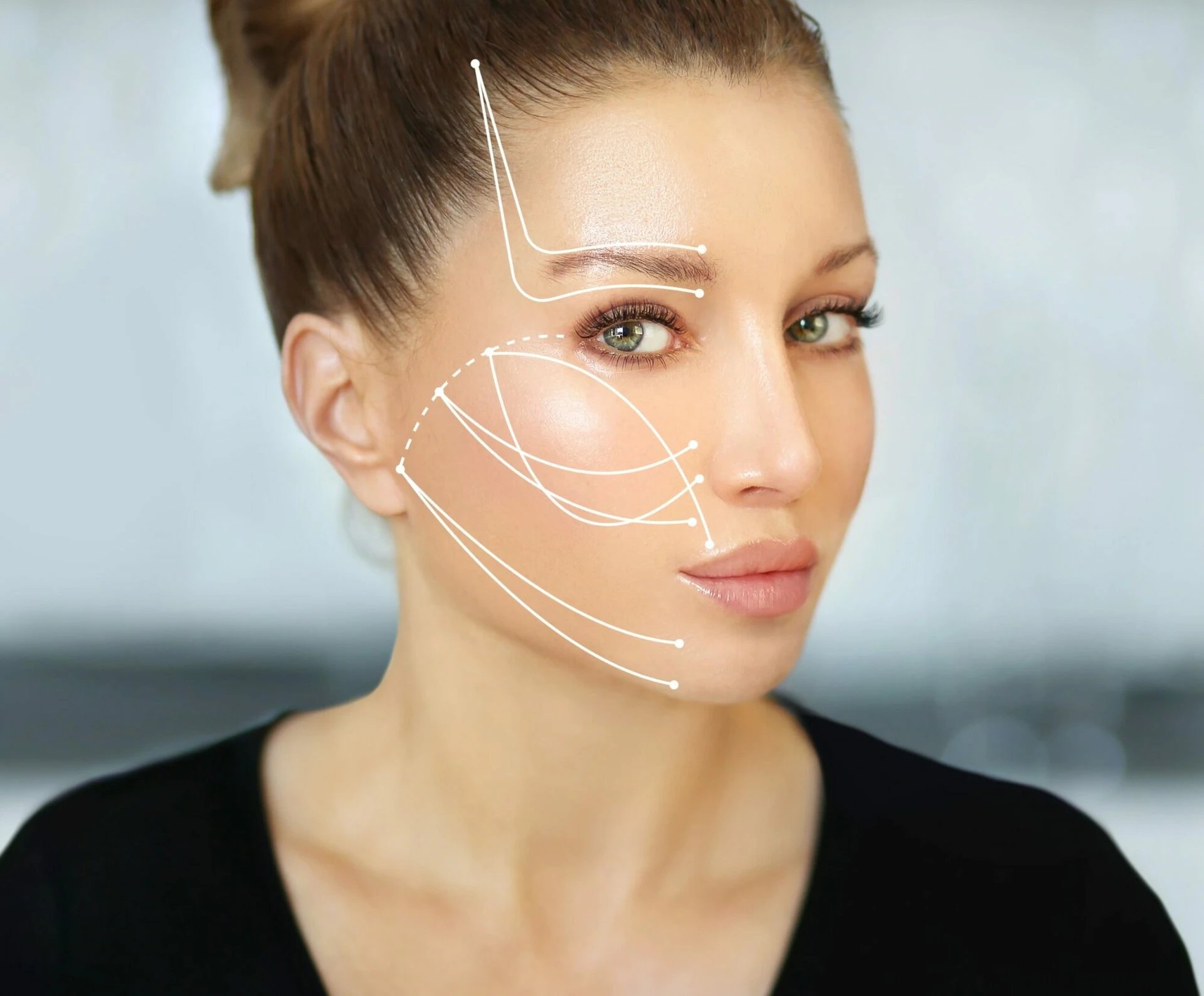 Facelift by MilfordMD Cosmetic Dermatology Surgery Laser Center in Milford