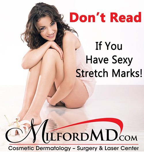 Stretch mark treatments for the not-so-sexy stretch marks available at MilfordMD.com in NEPA.