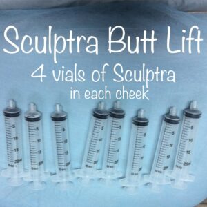 Sculptra Buttlift Procedure Using 8 Vials