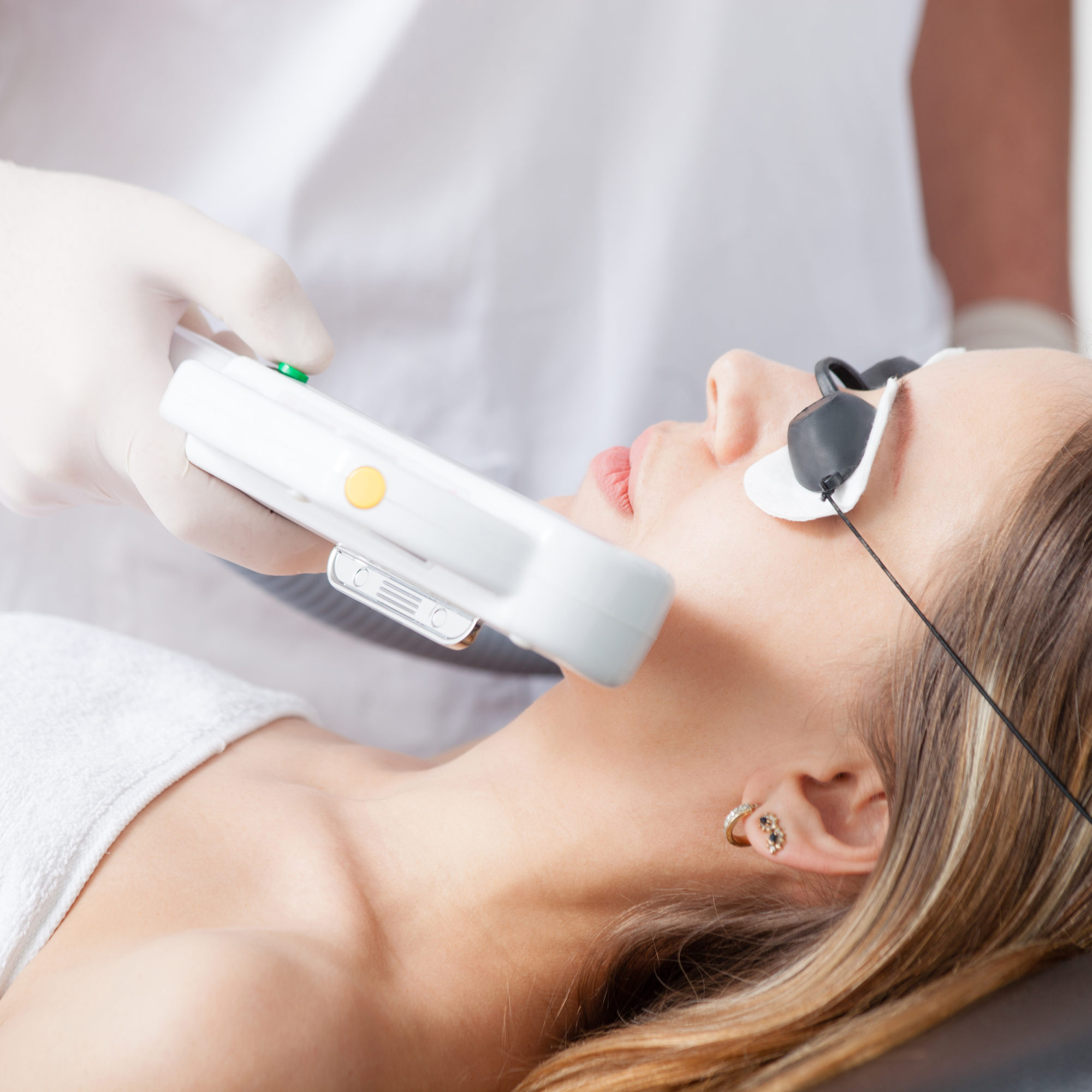 Laser Face Rejuvenation for Better Skin 9 Things You Must Know